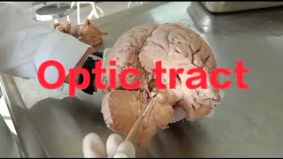 Neuroanatomy Optic pathway anatomy of optic pathway [upl. by Ocin63]