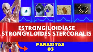 ESTRONGILOIDÍASE  STRONGYLOIDES STERCORALIS VERMINOSE  PARASITOLOGIA  INFECTOLOGIA [upl. by Asselam421]