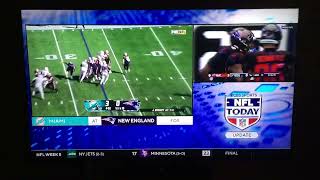 NFL on CBS Today Update Dolphins  Patriots on FOX [upl. by Julio]