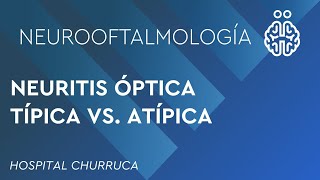 NEURITIS ÓPTICA TÍPICA VS ATÍPICA [upl. by Moina]