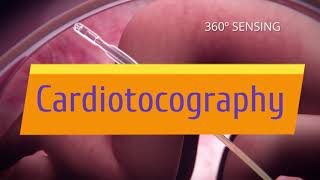 Cardiotocography Trailer [upl. by Aisanat620]