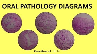 Oral Pathology Diagrams  BDS Third Year  Histopathology [upl. by Siuqaj]