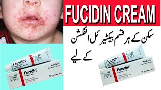 fusidic acid cream how to use Fusidic acid cream fucidin cream in urdu [upl. by Emilio897]