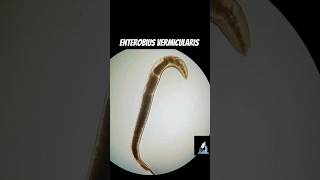 Enterobius vermicularis  Pinworm and its eggs [upl. by Seidnac]