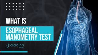 What is Esophageal Manometry Test  Dr Prabhat Narayan Sharma [upl. by Millar]