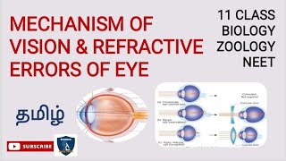 5 exercises to improve eyesight with myopia without surgeryHow to improve your vision at home [upl. by Omar]