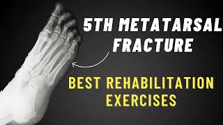 5th Metatarsal Fracture Exercises  6 Week Program [upl. by Esinehs]