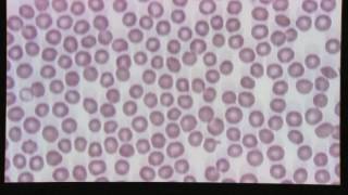 Blood Smear Evaluation [upl. by Ramonda336]