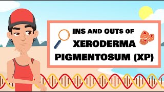 The Ins and Outs of XP Xeroderma pigmentosum [upl. by Sukey265]