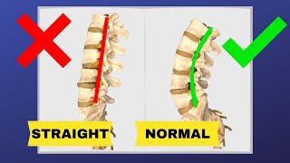 How To Correct Straightening Of Lumbar Spine FIX LOSS OF LUMBAR LORDOSIS  Dr Walter Salubro [upl. by Jarred]