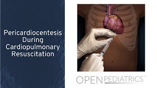 Pericardiocentesis During Cardiopulmonary Resuscitation by T Wolbrink  OPENPediatrics [upl. by Galatea676]