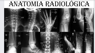 INTRODUÇÃO À ANATOMIA RADIOLÓGICA [upl. by Shirlene]