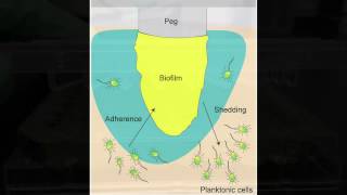 Video Biofilm Profiling Services  Minimal Biofilm Eradicating Concentration MBEC [upl. by Suryc111]