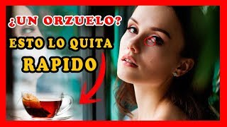 Como quitar un orzuelo del ojo rapido con remedios caseros naturalesRemedios para orzuelos [upl. by Kenzi]