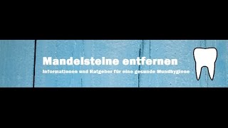 Mandelsteine entfernen  so einfach gehts [upl. by Rednijar]