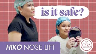 Hiko Nose Lift in 10 minutes  Dr Contessa Salvador [upl. by Adnorrahs]