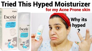 Excela Moisturizer Review  Best Moisturizer for Acne Prone skincare [upl. by Suirtemed225]