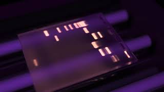 Gel Electrophoresis and Gel Analysis [upl. by Hanala726]