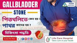 Gallstones Causes and Prevention  Dr A Rahaman [upl. by Finnigan]