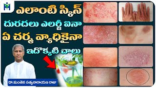 Skin Diseases Home Remedies in Telugu  Skin Allergy Oil  Charma  Dr Manthena Satyanarayana Raju [upl. by Asiulana482]