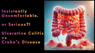 Ulcerative Colitis vs Crohns Disease [upl. by Ilrebmyk533]