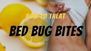 Bed Bug Bite Relief Effective Ways to Treat Bed Bug Bites  Remedies amp Tips [upl. by Valentin]