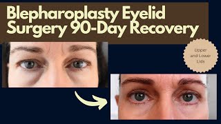 Eyelid surgery blepharoplasy 90day recovery with day by day before and after photos [upl. by Guod]