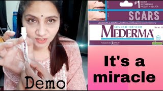 Mederma Cream Review amp Demo  Best Cream for Scars  Womens World [upl. by Vijar]