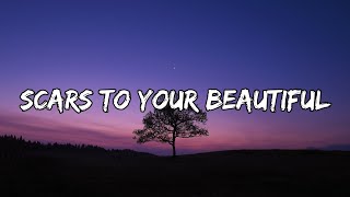 Alessia Cara Scars To Your Beautiful [upl. by Eidua636]