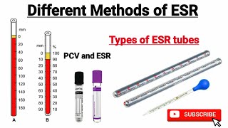 ESR test in hindi  Different methods of estimating ESR  ESR by Wintrobe and westergren Method [upl. by Ydissahc]