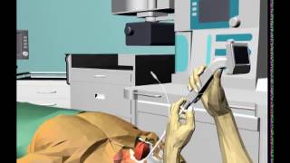 Trachway Demonstration Film  Anatomy versionMarkstein Sichtec Corp [upl. by Farris]