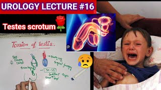 Urology surgery lecture 16 torsion of testis testicular appendages orchitis [upl. by Nylyahs]