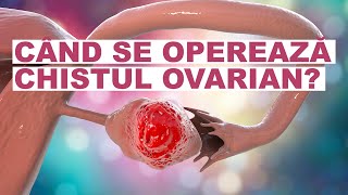 Chist ovarian când trebuie operat [upl. by Herwig]