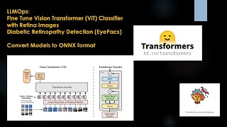 LLMOPS Fine Tune ViT Classifier with Retina Images Convert to ONNX machinelearning datascience [upl. by Ynaffik]