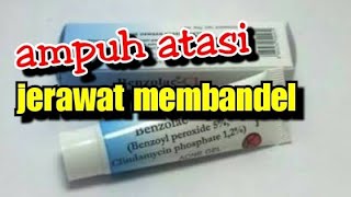 Cara pake Obat benzolac cl untuk jerawat efektif dan murah [upl. by Onitram]