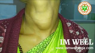 GOITER Thyroid Hypothyroidism Hyperthyroidism Thyroidgland Endocrine Glands Thyroidhormones [upl. by Novets]