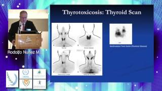 Monday Thyroid and Parathyroid Scintigraphy Rodolfo Nuñez [upl. by Pool955]