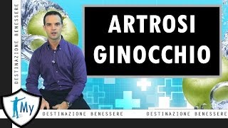 Artrosi del ginocchio [upl. by Comras34]