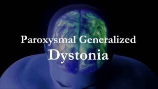 Dr Kukurin Paroxysmal Generalized Dystonia [upl. by Ingar766]