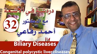 دردشة في الاشعة الحلقة 32  biliary system diseases 1 [upl. by Rentschler793]