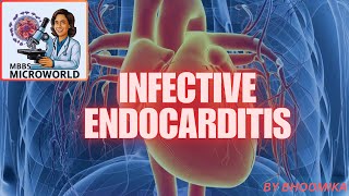 INFECTIVE ENDOCARDITIS [upl. by Davis]