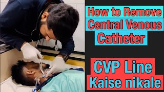 Central Line Removal viral doctor shortvideo cvp viral [upl. by Oicnanev]