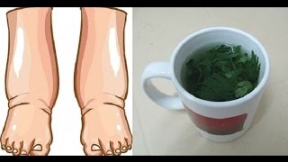 El Mejor Remedio Para Las PIERNAS HINCHADAS En Este Té de gran alcance ¡EFECTIVO [upl. by Maddalena]