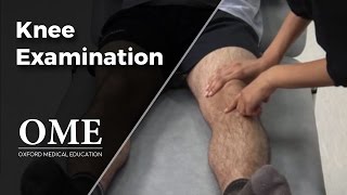 Knee Examination  Orthopaedics [upl. by Murtha850]