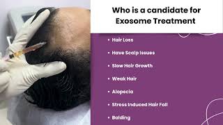 Exosome Treatment l Hair Loss l Balding l Hair Fall l Twacha l Dwarka l Delhi [upl. by Sension]