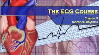 The ECG Course  Junctional Rhythms [upl. by Pike]