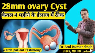 ovary Cyst treatment  Homeopathic treatment of ovarian cyst  ovary की गाँठ को कैसे ठीक करें [upl. by Enaenaj]