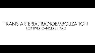 Radioembolization a cuttingedge treatment for liver cancer at its facility [upl. by Akeenat]