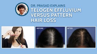 Differences Between Telogen Effluvium and Genetic Pattern Hair Loss [upl. by Initirb595]