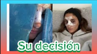 Lola Latorre se operó la nariz ¡Mira el cambio INCREÍBLE antes y después [upl. by Bethel]